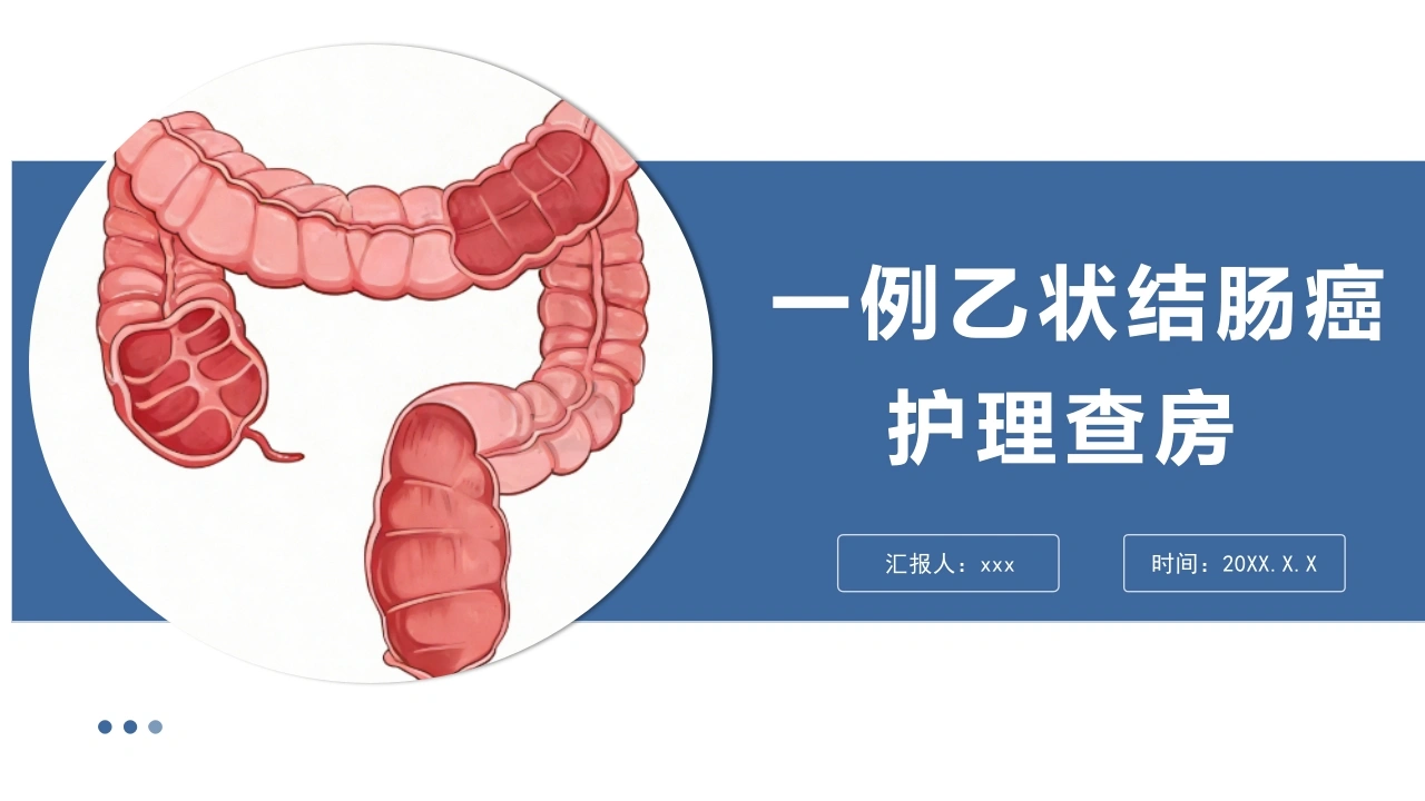 一例乙状结肠癌护理查房PPT课件模板