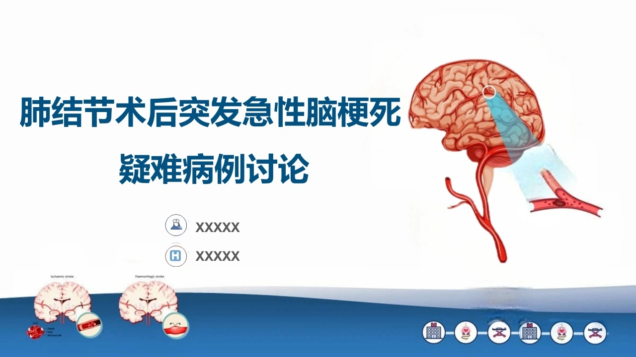 一例肺结节术后突发急性脑梗死疑难病例讨论-医护课栈