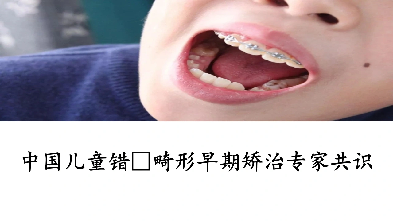 中国儿童错颌畸形早期矫治专家共识-医护课栈