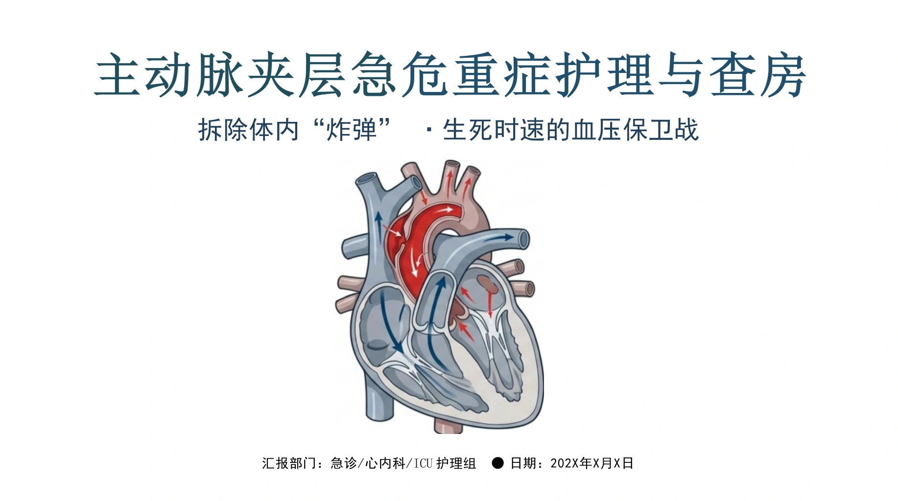 主动脉夹层急危重症护理查房-医护课栈