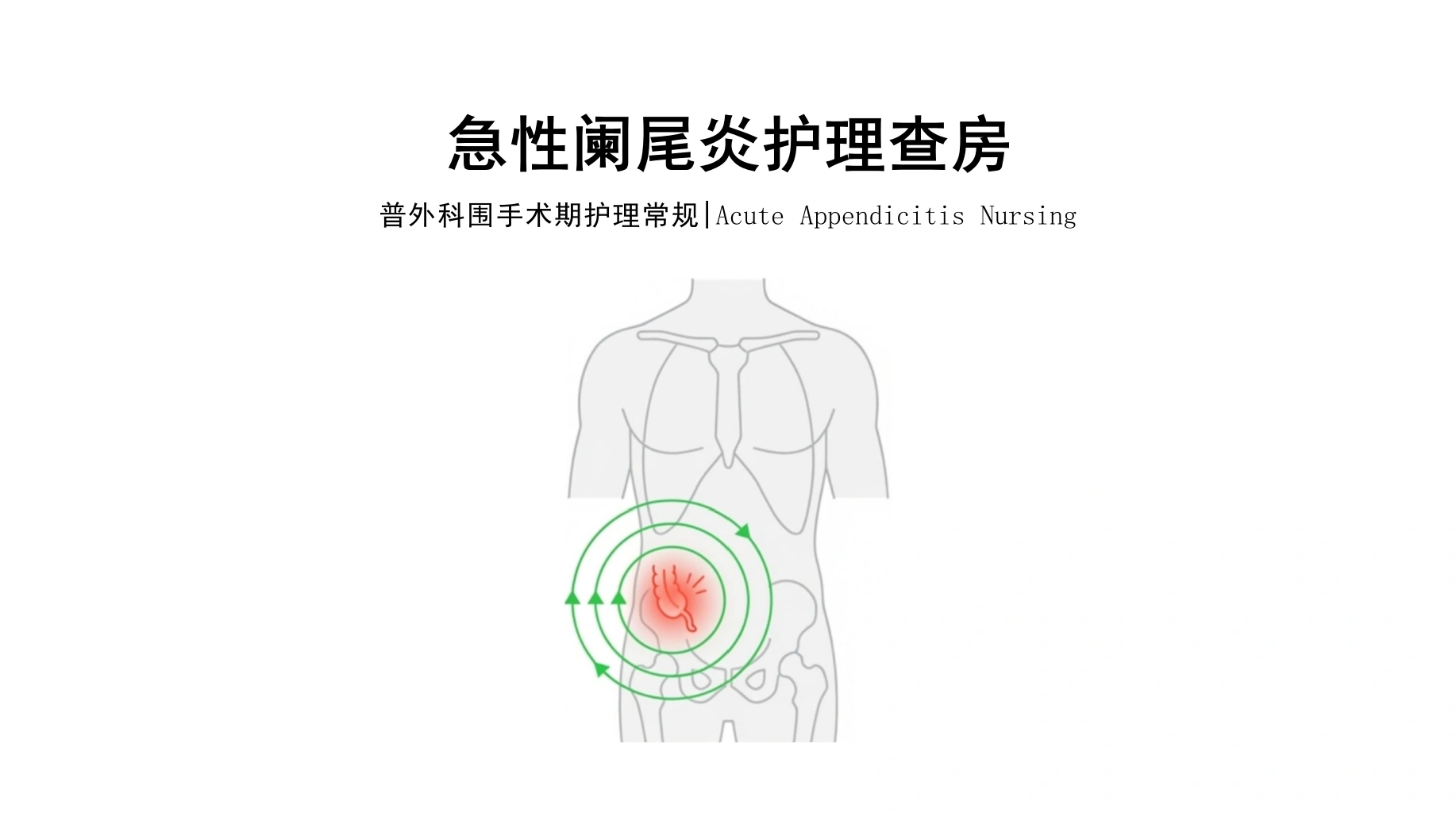 急性阑尾炎护理查房-医护课栈