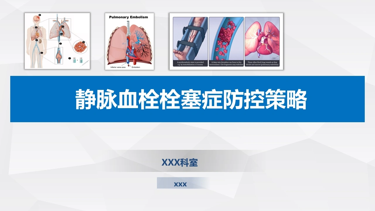 患者静脉血栓栓塞症防控策略-医护课栈