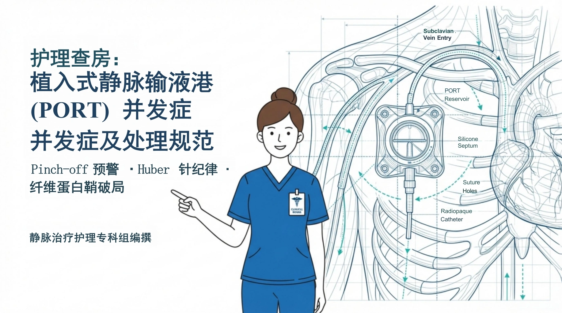 植入式静脉输液港并发症及处理规范-医护课栈