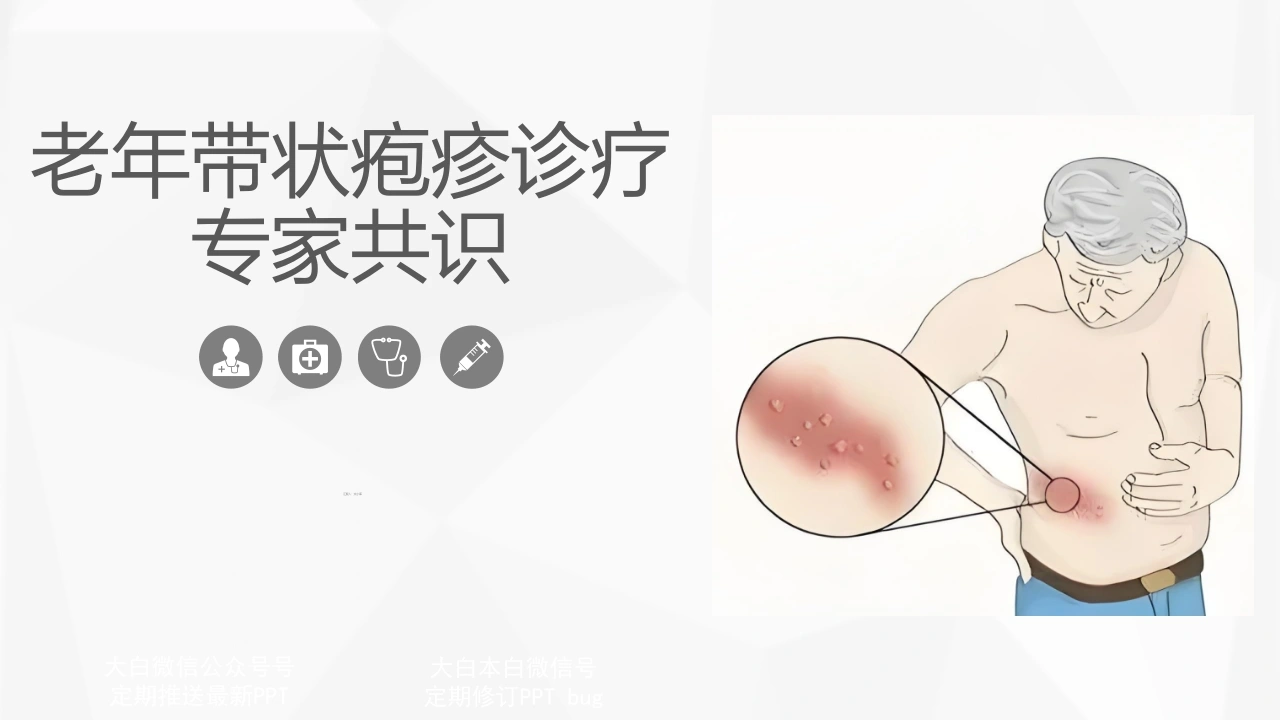 老年带状疱疹诊疗专家共识-医护课栈