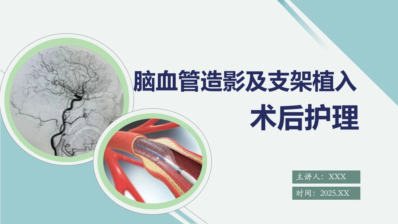 脑血管造影及支架植入术后护理PPT--神经介入护理精品课件-医护课栈