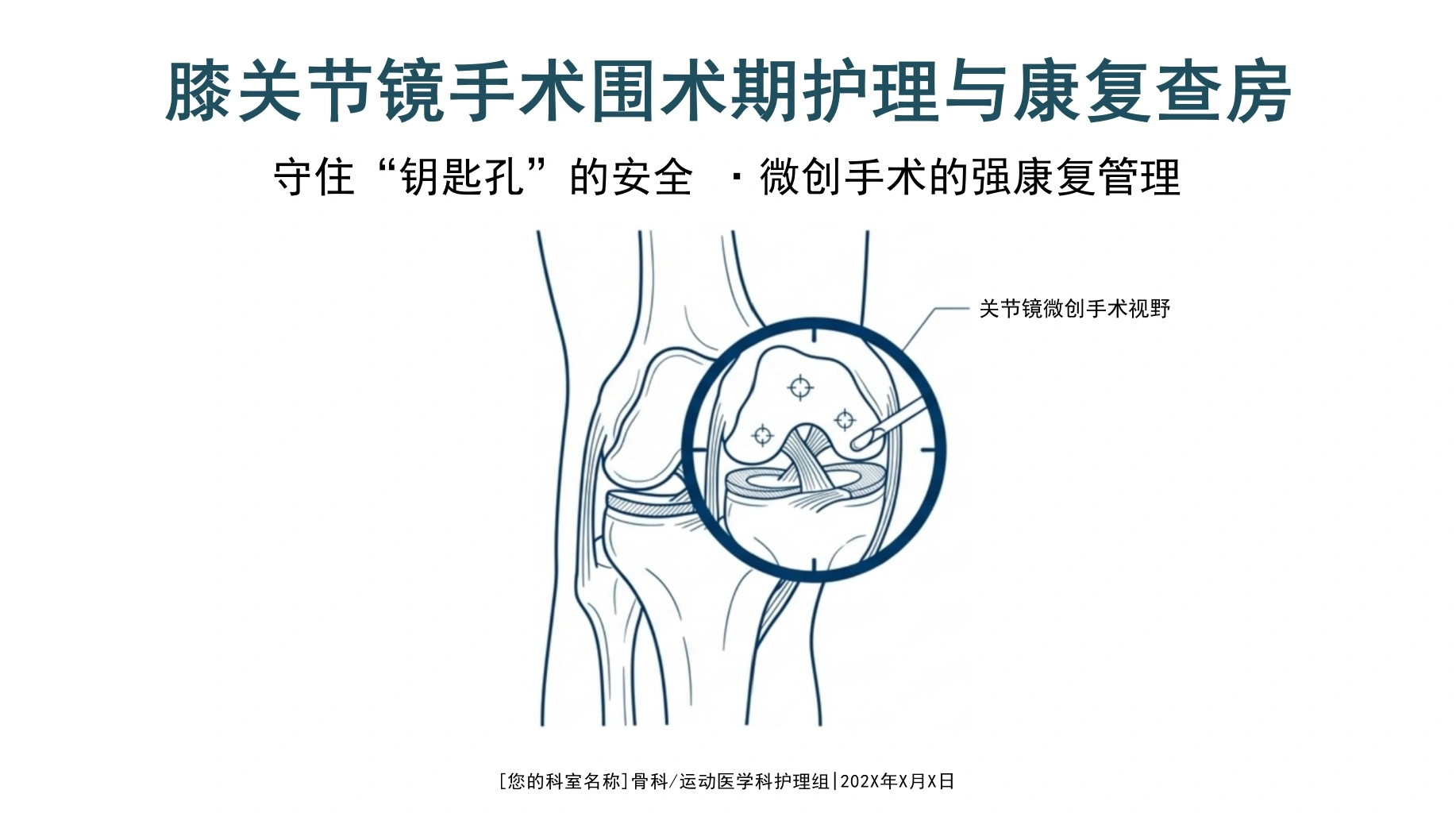 膝关节镜手术护理查房-医护课栈
