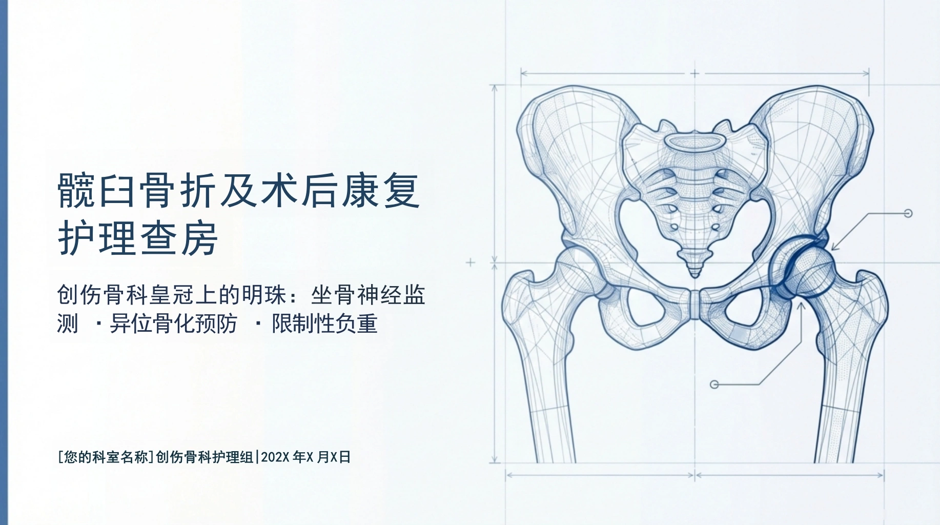 髋臼骨折护理查房-医护课栈